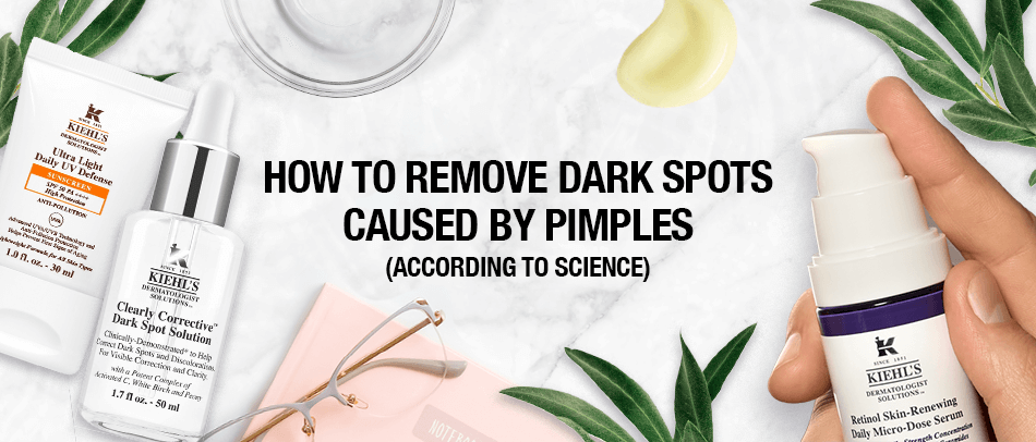 How to Remove Dark Spots from Pimples According to Science